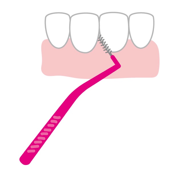 歯間ブラシの使い方図