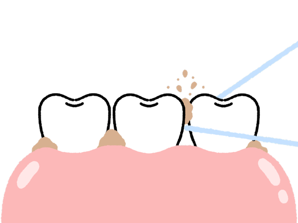 デンタルフロスの使い方図
